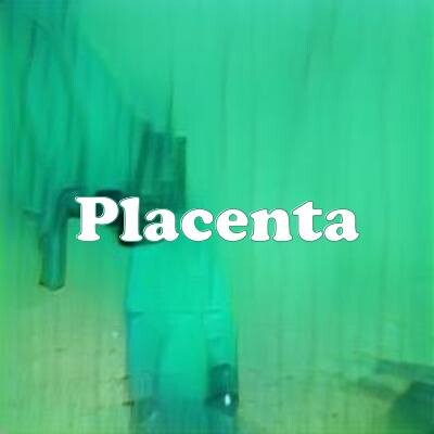 Placenta strain